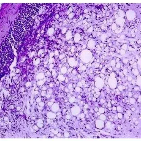 thumbnail for publication: Viral Nervous Necrosis (Betanodavirus) Infections in Fish